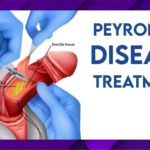 peyronie's disease treatment 2023
